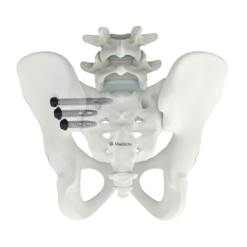 Medacta SI en pelvisschroeven hoofdafbeelding 2 (1)