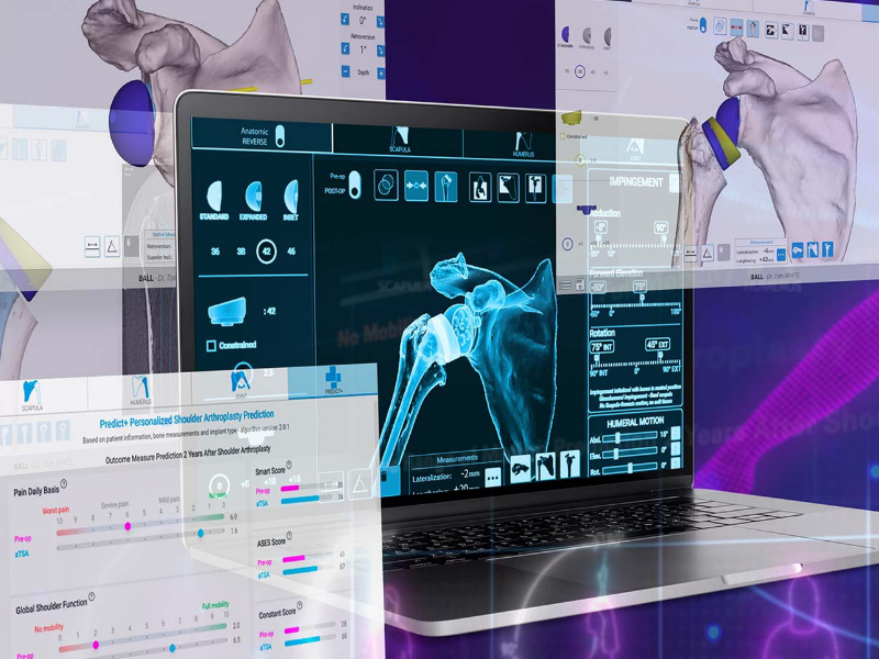 Shoulder planning app nieuwsitem